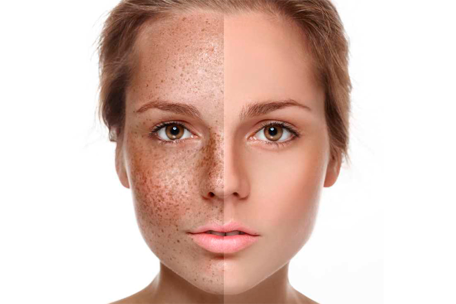 Как отбелить лицо за 1 день в домашних условиях