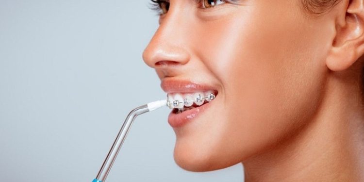 Ирригатор для полости рта: назначение, функционал, особенности выбора