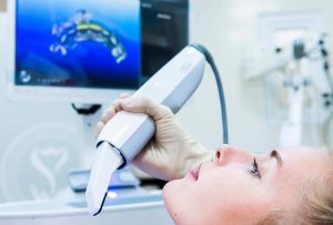 Элайнеры Инвизилайн: отзывы клиентов в Москве