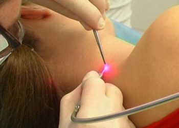 Как удалить бородавку