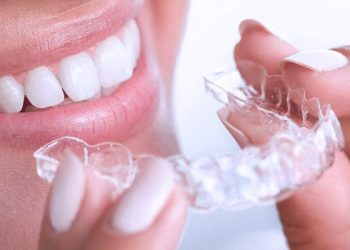 ЭЛАЙНЕРЫ ДЛЯ ВЫРАВНИВАНИЯ ЗУБОВ: современное решение для идеальной улыбки