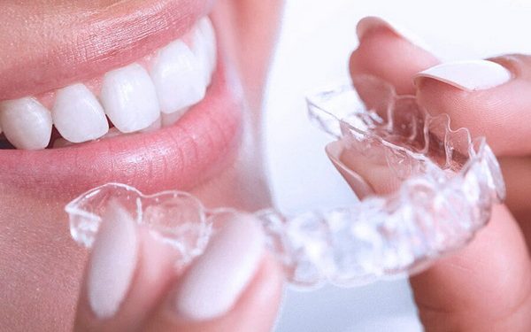 ЭЛАЙНЕРЫ ДЛЯ ВЫРАВНИВАНИЯ ЗУБОВ: современное решение для идеальной улыбки