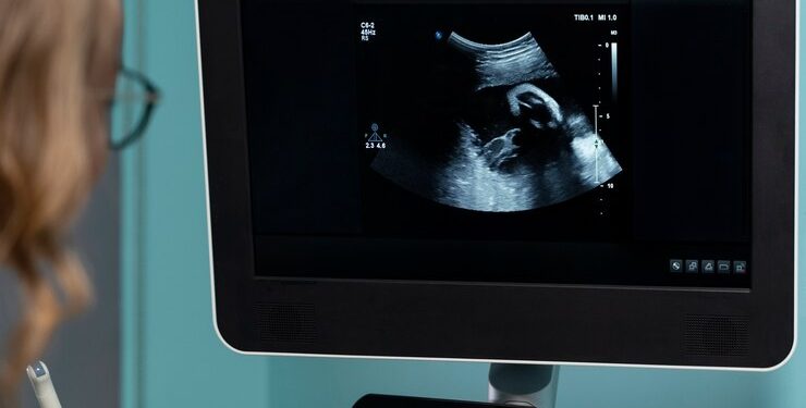 Что представляет собой сканер УЗИ Mindray MX7: характеристики, достоинства, применение