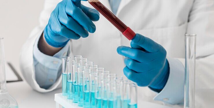 Анализы крови: виды и описание