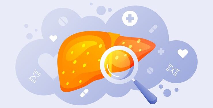 Фиброз печени: что он из себя представляет