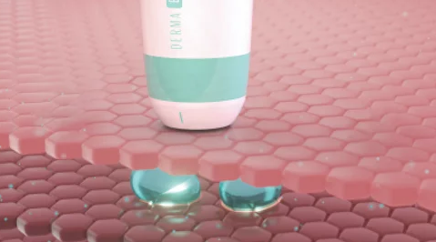 Показания к SMAS-лифтингу