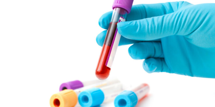 Как грамотно подготовиться к сдаче анализов: рекомендации врачей