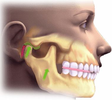 Лечение заболеваний височно-нижнечелюстного сустава (ВНЧС): подходы и методы