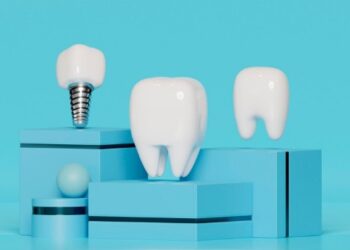 Имплантация зубов: надёжное и эстетичное решение для утраченных зубов