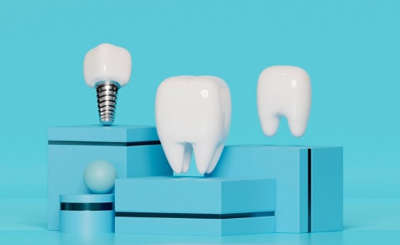 Имплантация зубов: надёжное и эстетичное решение для утраченных зубов