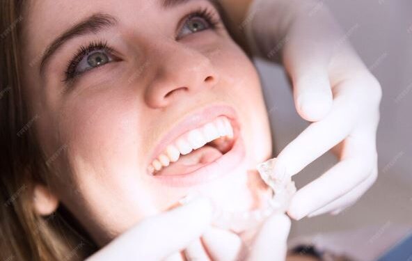 Керамические виниры: эстетика и функциональность в современном стоматологическом лечении