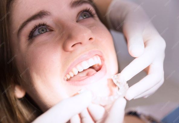 Керамические виниры: эстетика и функциональность в современном стоматологическом лечении